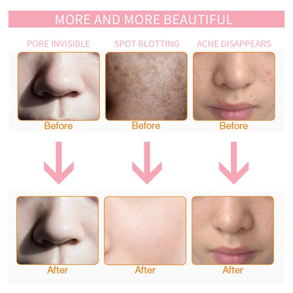 7 Colors LED Face Neck Mask  Whitening  Anti-Wrinkle LED Skin Care Anti Acne Removal Mask Face Mask Beauty SPA Wrinkle Remover